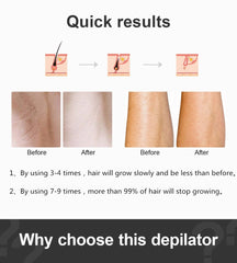 Ultrafast IPL Hair Removal Handset - Lusty Age