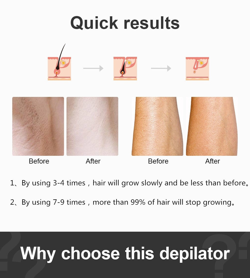 Ultrafast IPL Hair Removal Handset - Lusty Age